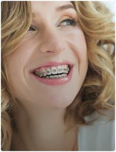 TRADITIONAL BRACES